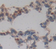 Polyclonal Antibody to Programmed Cell Death Protein 1 (PD1)