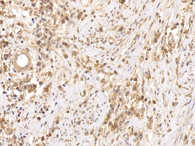 Polyclonal Antibody to Cluster Of Differentiation 38 (CD38)