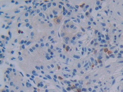 Polyclonal Antibody to Neuropeptide S (NPS)
