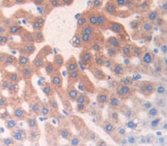 Polyclonal Antibody to Complement Component 3 (C3)