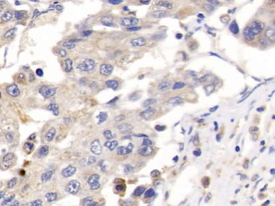Polyclonal Antibody to Placental Lactogen (PL)