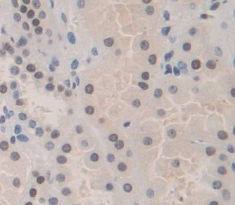 Polyclonal Antibody to Retinoblastoma Protein 1 (RB1)