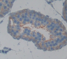 Polyclonal Antibody to Tumor Necrosis Factor Receptor Superfamily, Member 5 (CD40)