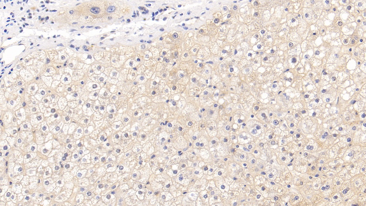 Polyclonal Antibody to Cluster Of Differentiation 73 (CD73)