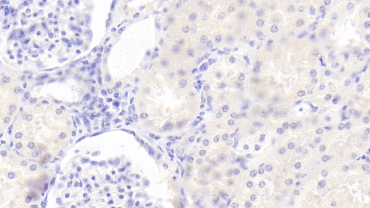 Polyclonal Antibody to Thymic Stromal Lymphopoietin (TSLP)