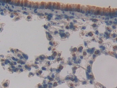 Polyclonal Antibody to Ataxia Telangiectasia Mutated (ATM)
