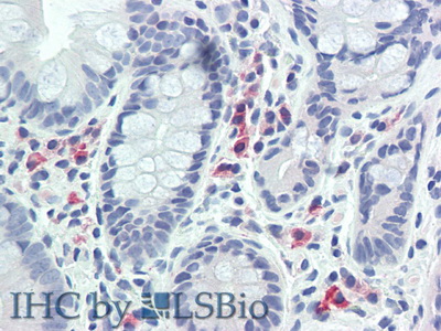 Polyclonal Antibody to Cluster of Differentiation 79B (CD79B)