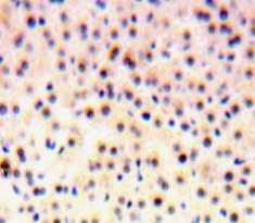 Polyclonal Antibody to Nuclear Pore Glycoprotein 210 (gp210)