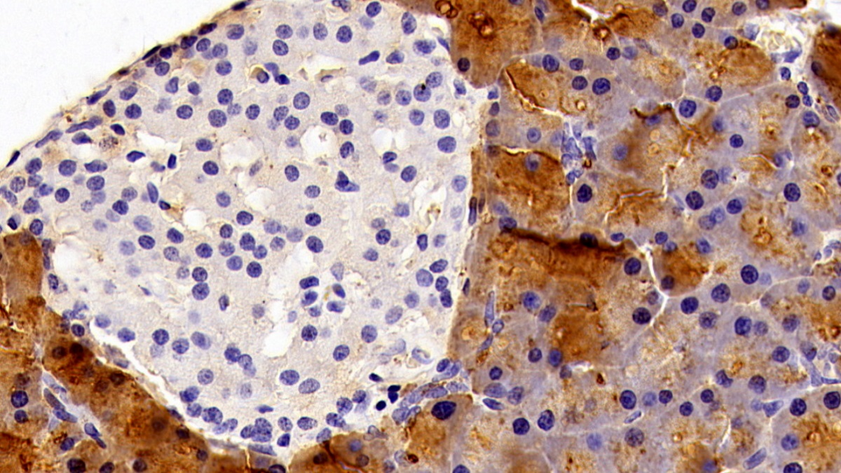 Polyclonal Antibody to Pancreatic Lipase (PL)