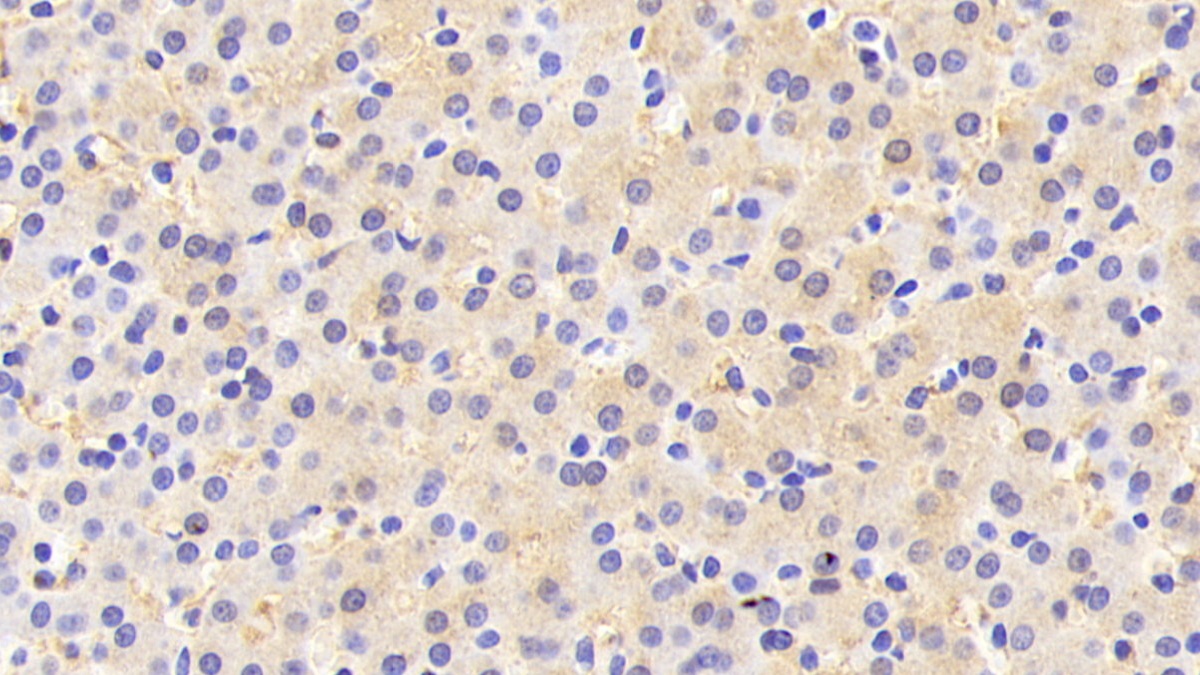 Polyclonal Antibody to Colony Stimulating Factor Receptor, Macrophage (MCSFR)