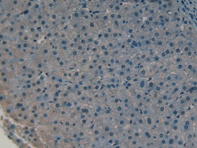 Polyclonal Antibody to Collectin Liver 1 (CLL1)