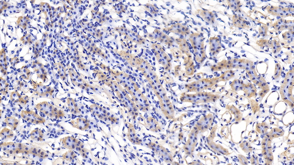 Polyclonal Antibody to Tumor Necrosis Factor Receptor Superfamily, Member 1B (TNFRSF1B)