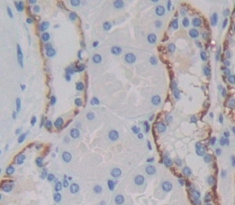 Polyclonal Antibody to Interleukin-18 Receptor Beta (IL18R Beta)