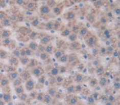 Polyclonal Antibody to Solute Carrier Family 27 Member 5 (SLC27A5)