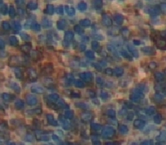 Polyclonal Antibody to Cluster Of Differentiation 229 (CD229)