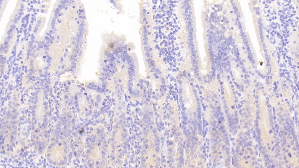 Polyclonal Antibody to Cluster Of Differentiation (CD163)