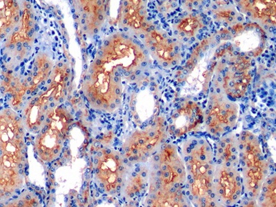 Polyclonal Antibody to Neprilysin (CD10)
