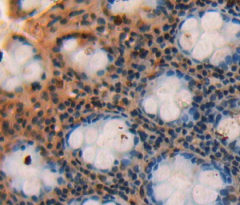 Polyclonal Antibody to Small Breast Epithelial Mucin (SBEM)