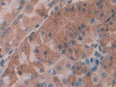Polyclonal Antibody to Interleukin 35 (IL35)