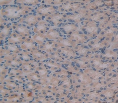 Polyclonal Antibody to High Mobility Group AT Hook Protein 1 (HMGA1)