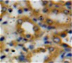Polyclonal Antibody to Decorin (DCN)