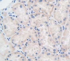 Polyclonal Antibody to Profilin 1 (PFN1)