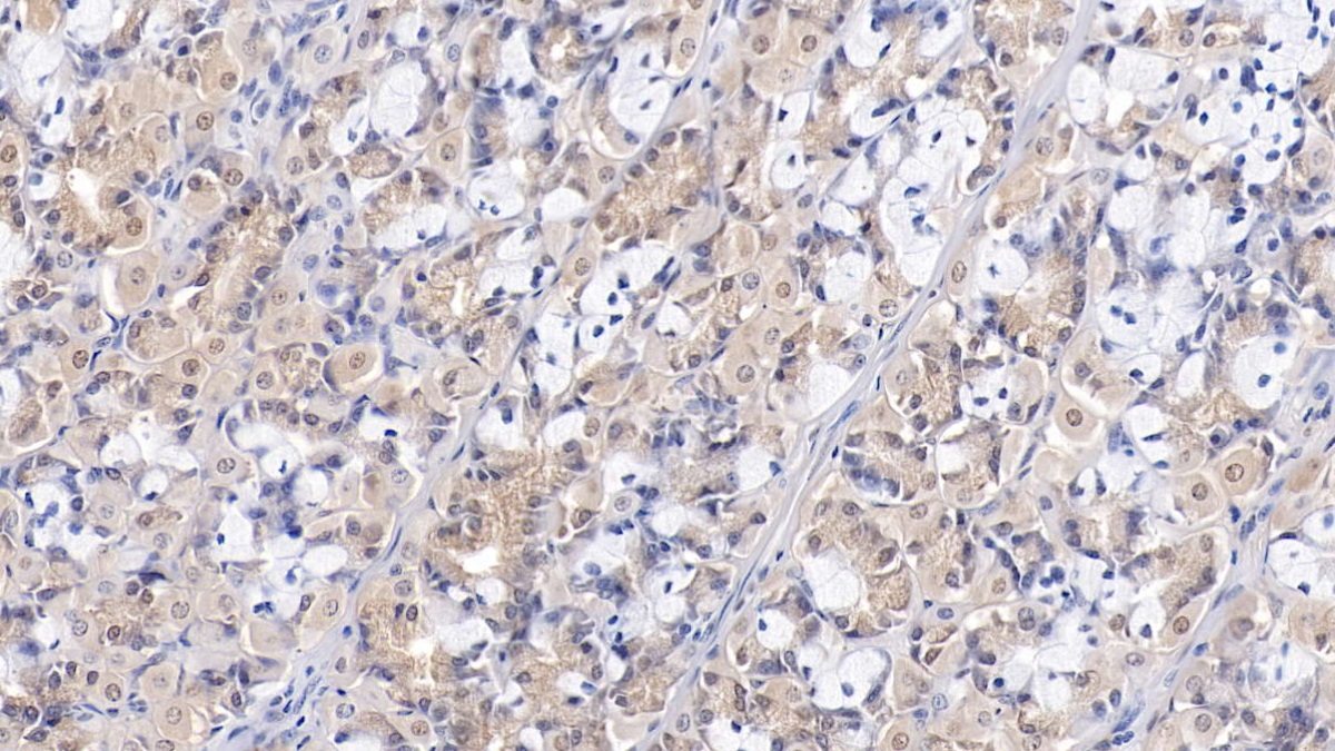 Polyclonal Antibody to Wilms Tumor 1 Associated Protein (WTAP)