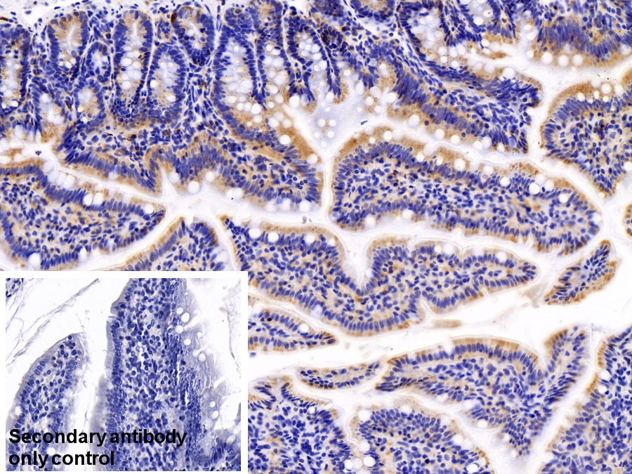 Polyclonal Antibody to Mesencephalic Astrocyte Derived Neurotrophic Factor (MANF)