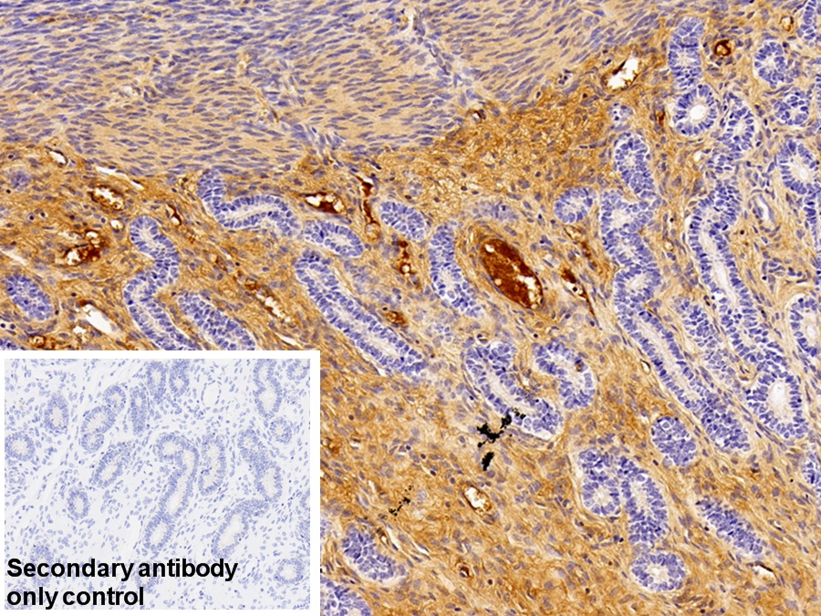 Polyclonal Antibody to Antithrombin (AT)