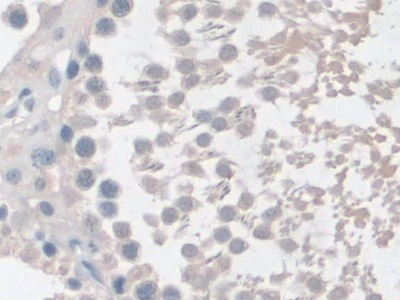 Polyclonal Antibody to Butyrylcholinesterase (BCHE)