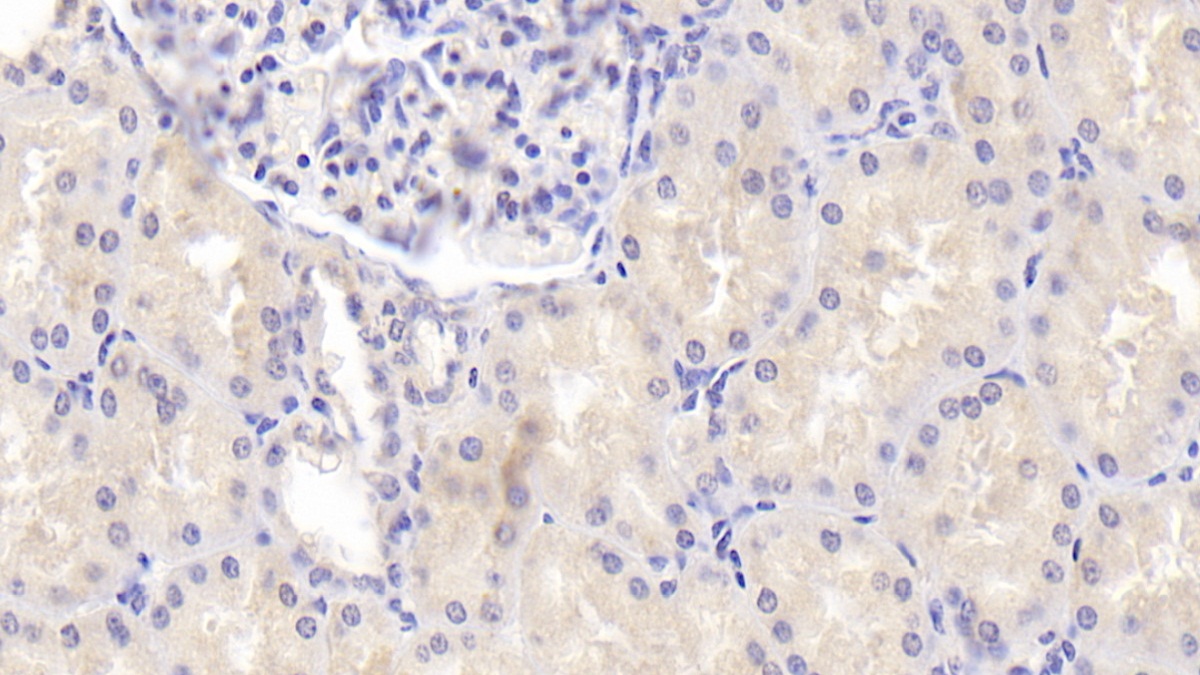 Polyclonal Antibody to Endonuclease G, Mitochondrial (ENDOG)