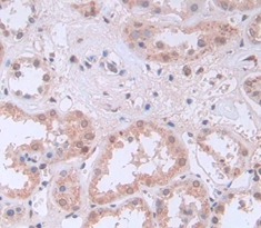 Polyclonal Antibody to Pim-1 Oncogene (PIM1)