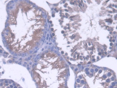 Polyclonal Antibody to Osteosarcoma Amplified 9 (OS9)