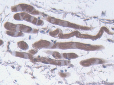 Polyclonal Antibody to Perilipin 1 (PLIN1)