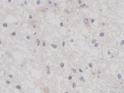 Polyclonal Antibody to Tumor Necrosis Factor Alpha Induced Protein 3 (TNFaIP3)