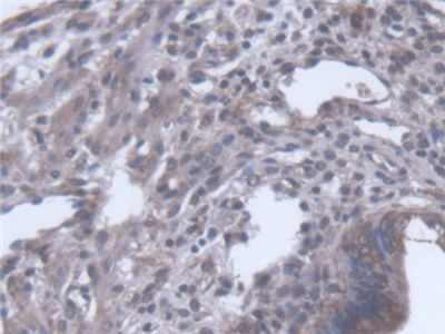 Polyclonal Antibody to Sciellin (SCEL)