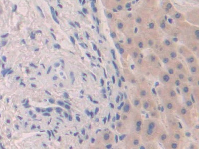 Polyclonal Antibody to Fibroblast Growth Factor 19 (FGF19)