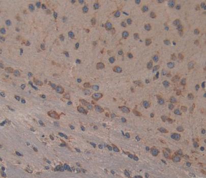 Polyclonal Antibody to Collagen Type III Alpha 1 (COL3a1)