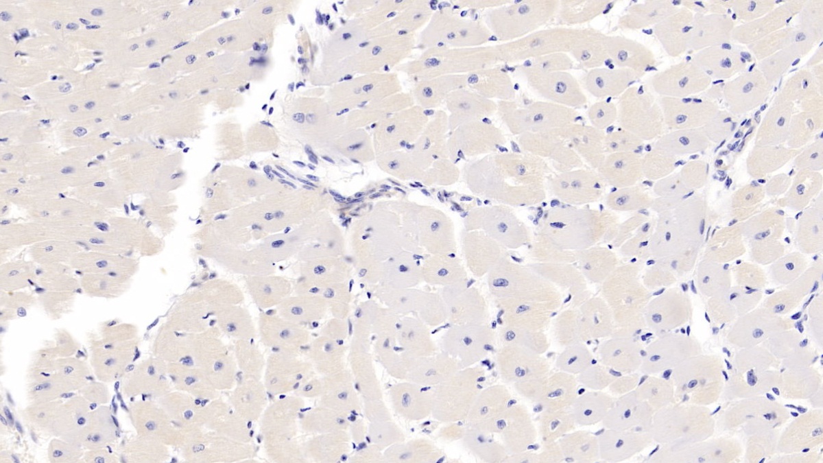 Polyclonal Antibody to Sjogren Syndrome Antigen A1 (SSA1)