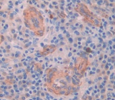 Polyclonal Antibody to Myosin VA (MYO5A)