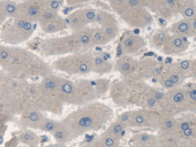 Polyclonal Antibody to Survival Of Motor Neuron 2, Centromeric (SMN2)