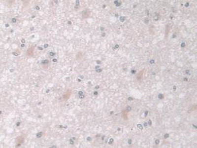 Polyclonal Antibody to Mitogen Activated Protein Kinase 12 (MAPK12)