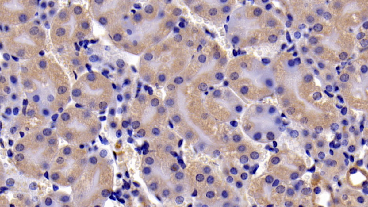 Polyclonal Antibody to B-Cell CLL/Lymphoma 2 Like Protein (Bcl2L)
