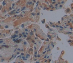 Polyclonal Antibody to Karyopherin Alpha 1 (KPNa1)