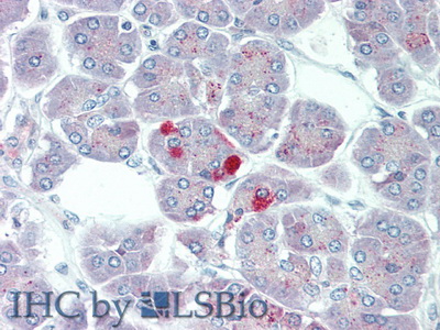 Polyclonal Antibody to Carboxypeptidase B1, Tissue (CPB1)