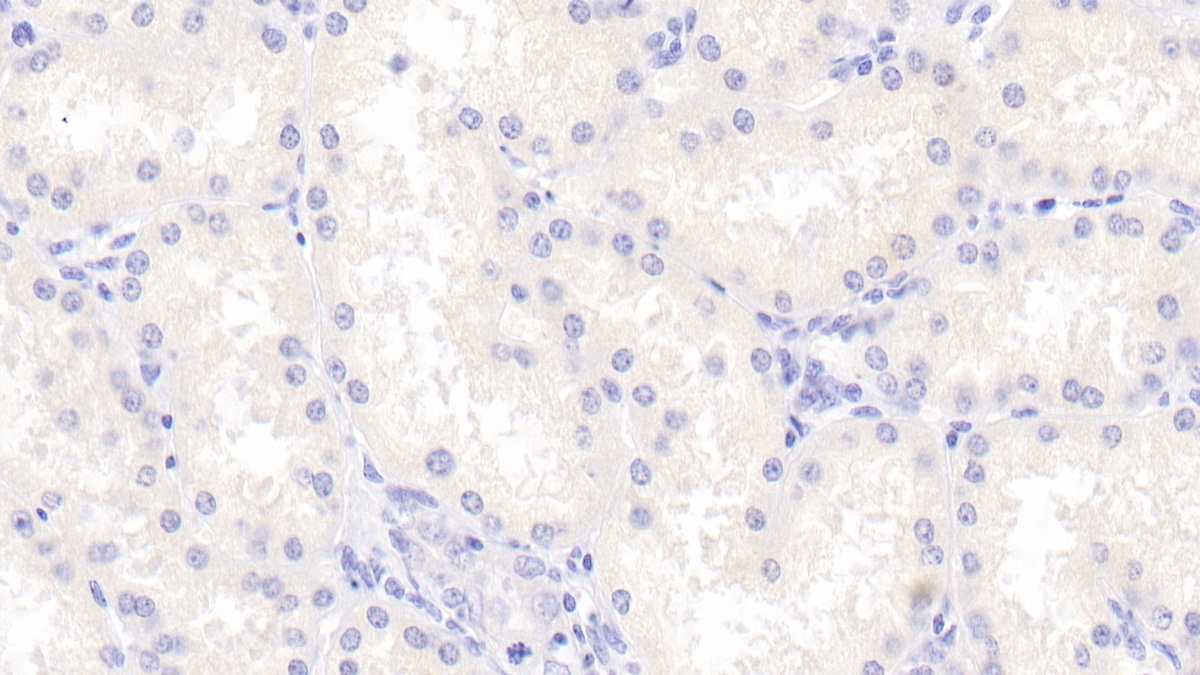 Polyclonal Antibody to Cerebellin 1 (CBLN1)