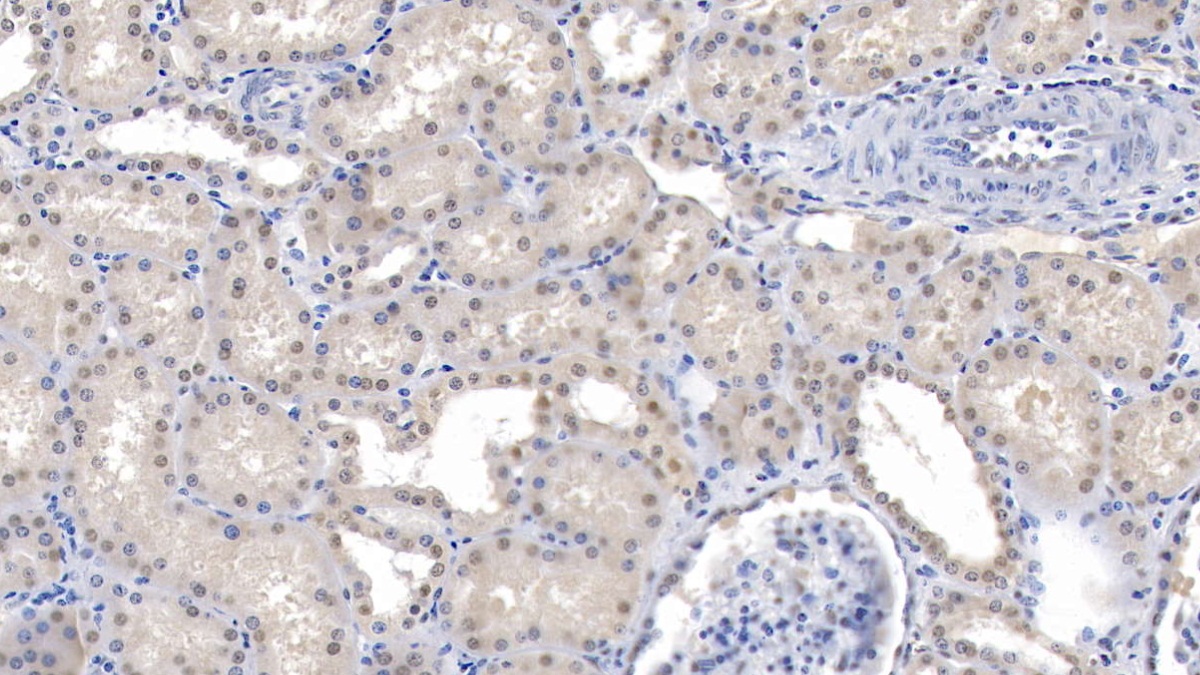 Polyclonal Antibody to Translocation Associated Notch Homolog 1 (TAN1)