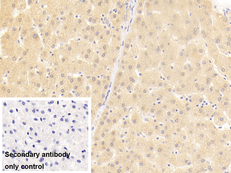Polyclonal Antibody to Hepatocyte Growth Factor Regulated Tyrosine Kinase Substrate (HGS)