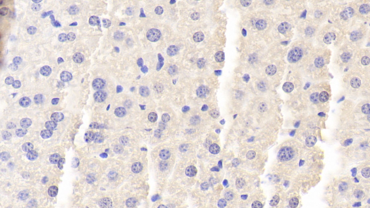 Polyclonal Antibody to Biglycan (BGN)