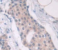 Polyclonal Antibody to Cancer/Testis Antigen 1B (CTAG1B)